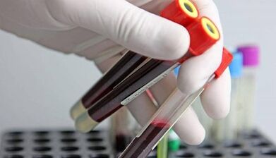 Comment passer des tests de parasites dans le corps