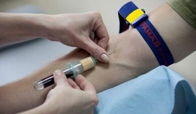 Comment se préparer au test parasite