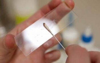 Quelles preuves doivent être prises pour les parasites