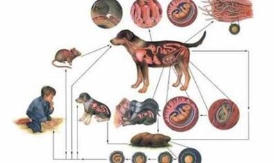 Causes et formes d'infection par des vers
