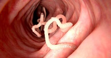 Les causes des parasites dans le corps humain