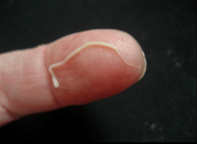 parasite ascaris du corps humain